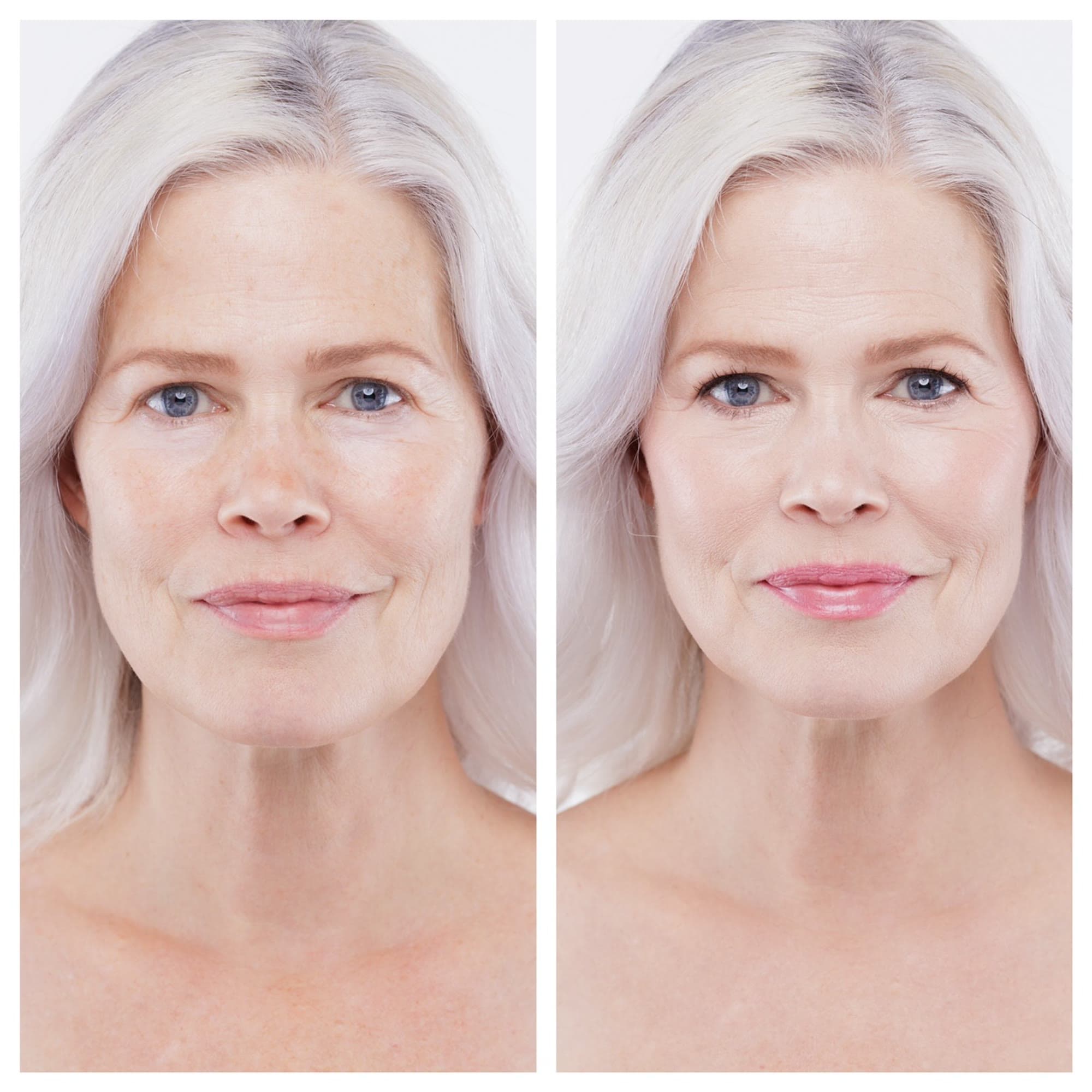Before & After #1
