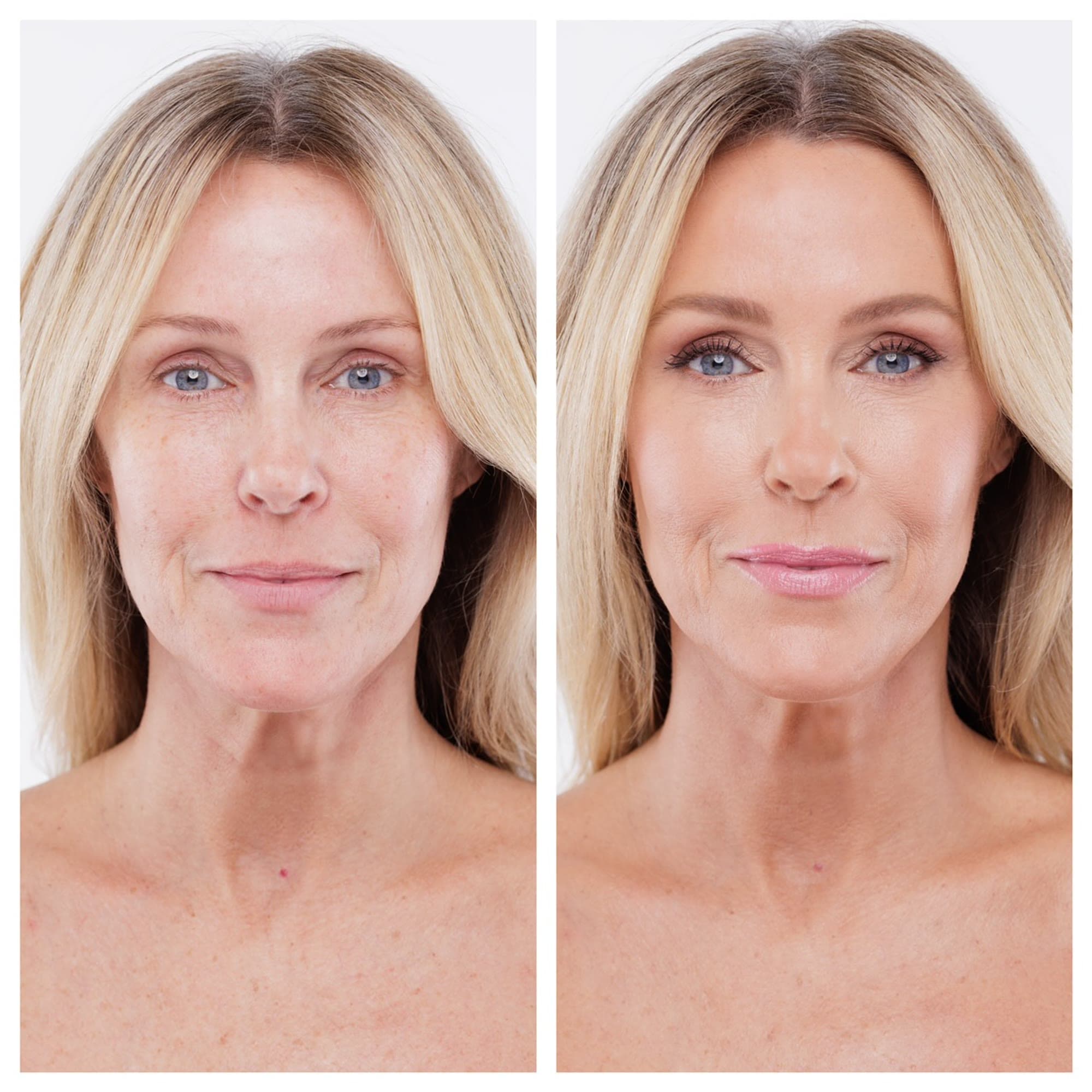 Before & After #2