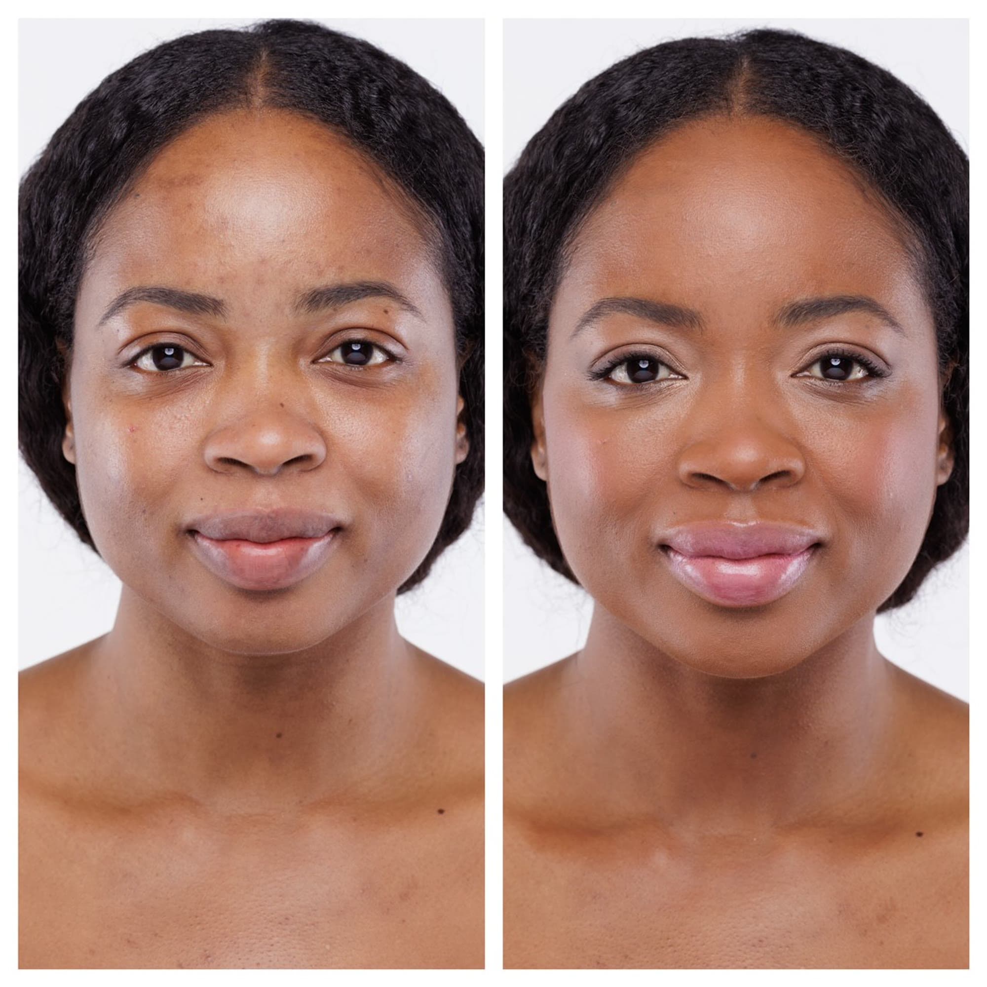 Before & After #3
